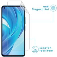 imoshion ﻿Displayschutz Folie 3er-Pack Xiaomi Mi 11 Lite (5G/4G) / 11 Lite 5G NE